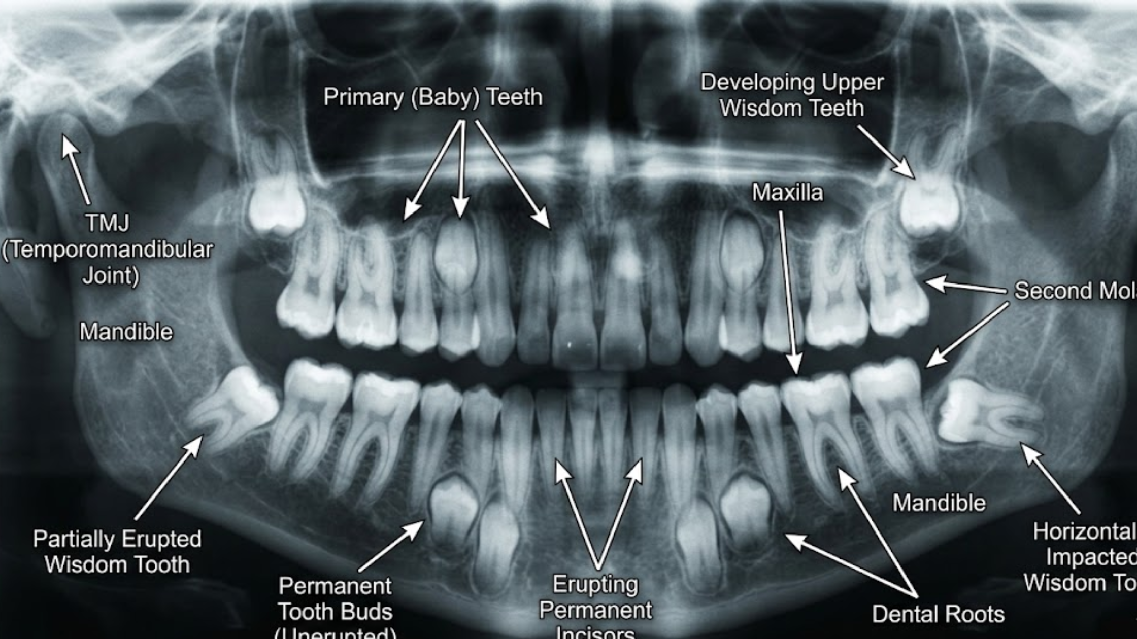 From Baby Teeth to Wisdom Teeth